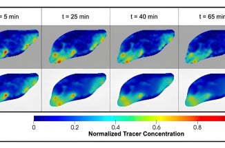 Blue and green blobs indicate MRI results tested on a mouse brain