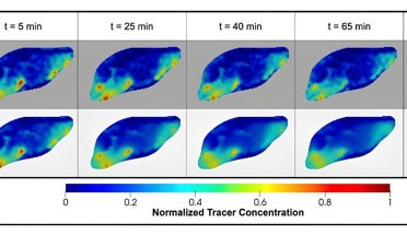 Blue and green blobs indicate MRI results tested on a mouse brain